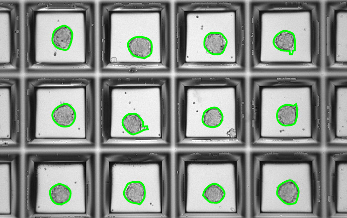 Detection of 3D-cell aggregates